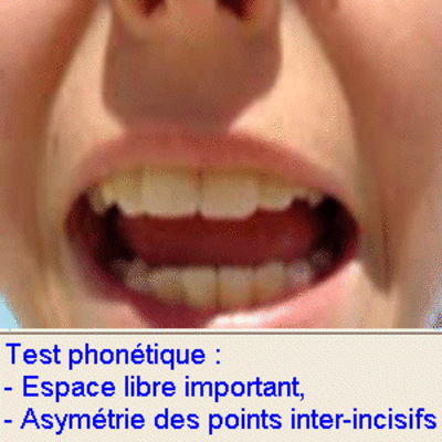 01 test phonetique ojnnrd - Eugenol
