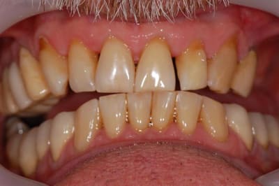 023 gvvpmg - Eugenol