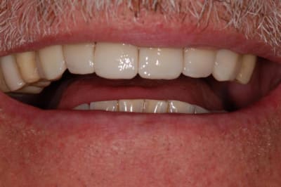 036 sv2k6z - Eugenol