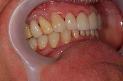 038 fmd8bs - Eugenol