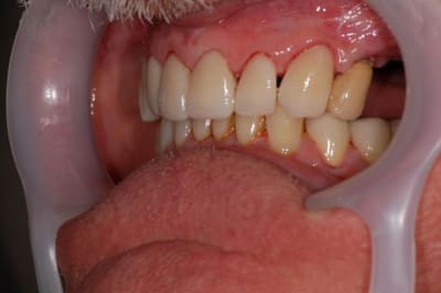 039 hx5tup - Eugenol