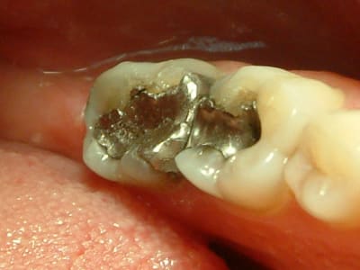 04090714 ykd2av - Eugenol