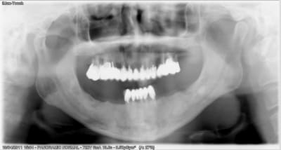 04890001 h2hqsv - Eugenol