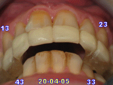 050420 rmda c3nlpw - Eugenol