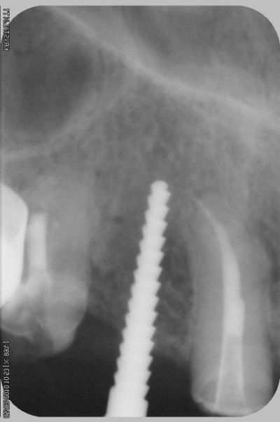 050 hov3nx - Eugenol