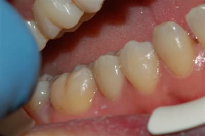 055 weszh5 - Eugenol