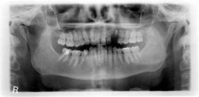06711 x 0000016b 3 x3mtyv - Eugenol