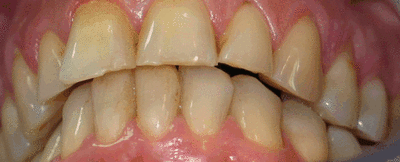 07 oimg volontaire o38qul - Eugenol