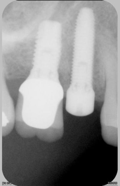 081 jpeg wado3b - Eugenol