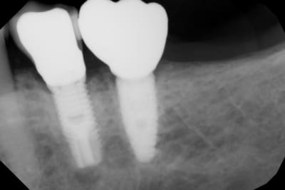 0gej565e0dgqo9gknnnz9gu580rw - Eugenol