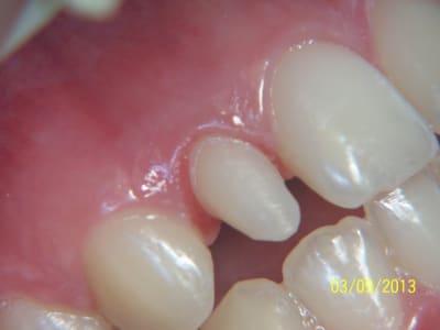 100 1319 qetflz - Eugenol