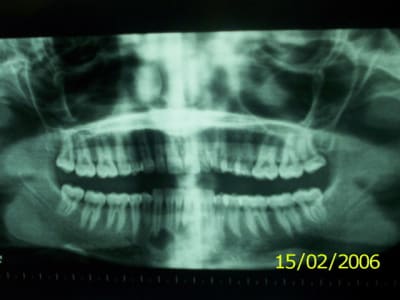 100 5781 ovkbye - Eugenol