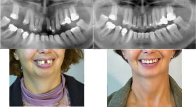 10343 07 juin fin 4 c35anj - Eugenol