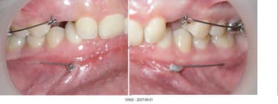 10992 2007 06 01  sfwwkx - Eugenol