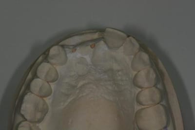 11 12 6 y3iz2r - Eugenol