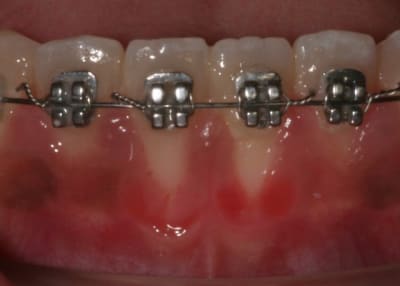 111 g8jnb4 - Eugenol