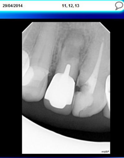 11 12 13 vgaghg - Eugenol