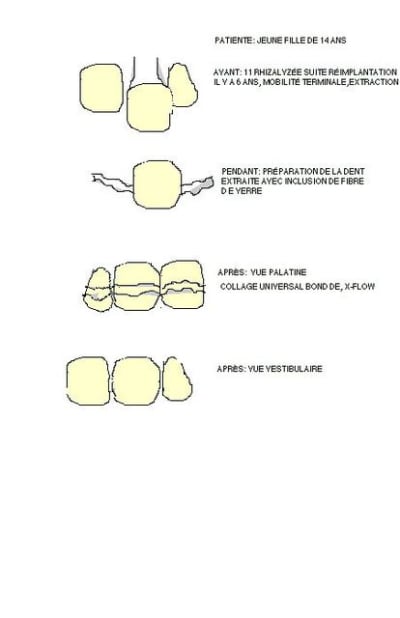 11 extraite  ousvt7 - Eugenol