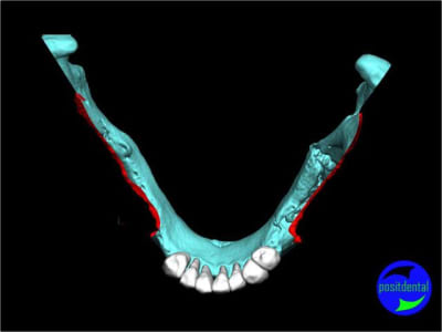 11 positdental mod lisation 3d wq2tex - Eugenol