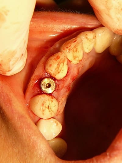 11 mrjb2e - Eugenol