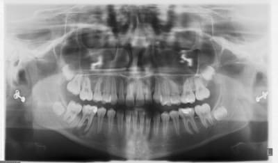12 03 2008 g2x3kb - Eugenol