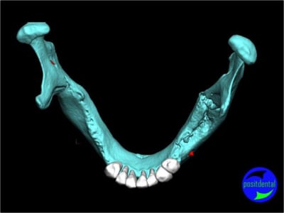 12 positdental mod lisation 3d h9tylw - Eugenol
