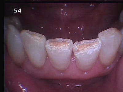 141 do0s3w - Eugenol