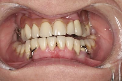 15 js tqkqoj - Eugenol