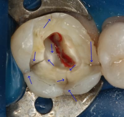 16 3 engkts - Eugenol