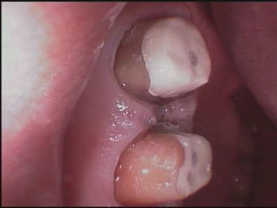 16 17 vue vextibulaire wv12w8 - Eugenol