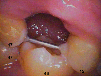 16 46 muwqsd - Eugenol