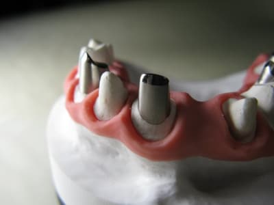 190336 182869735091071 7752171 n ftgg3b - Eugenol