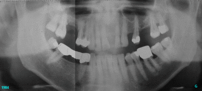 1984 1984 kme59k - Eugenol