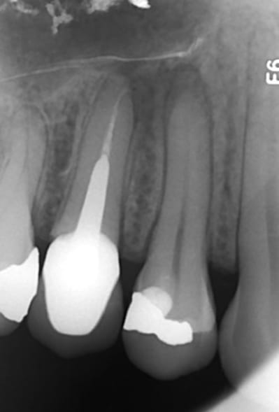 1   29042014 irnqhe - Eugenol