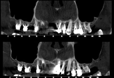1 1 f0i4i7 - Eugenol