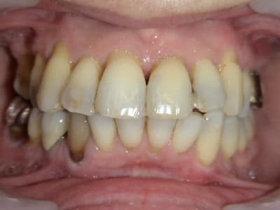 1 an plus tard 2 iiyidu - Eugenol