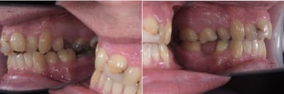 1 il2vab - Eugenol
