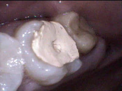 1 lqne8e - Eugenol