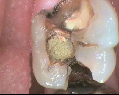 1 photo initiale dl0jwg - Eugenol