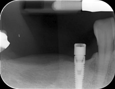 1g9ss3somne40zuf2eav6xg4t4kv - Eugenol