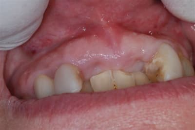 2008 01 25 011 dulu2y - Eugenol