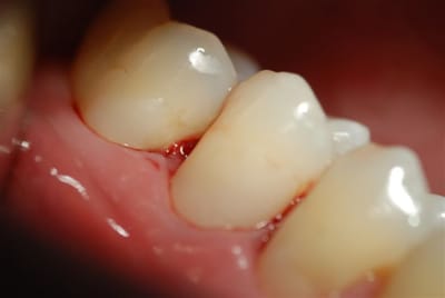 2009 06 09 022 kczlld - Eugenol