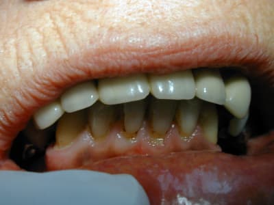 2009 11 27  5  acjuur - Eugenol