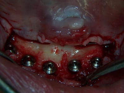 2010.04 - Eugenol