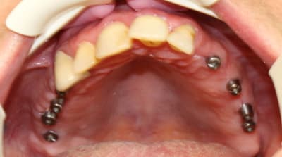 2010 04 20 0125r pc13kf - Eugenol
