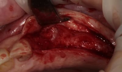 2010 05 28 0283w i5gdj9 - Eugenol