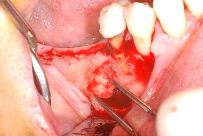 2011 07 01b 006 cbbrs9 - Eugenol