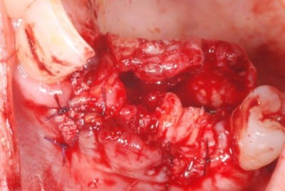 2011 09 15 011 nduqf3 - Eugenol