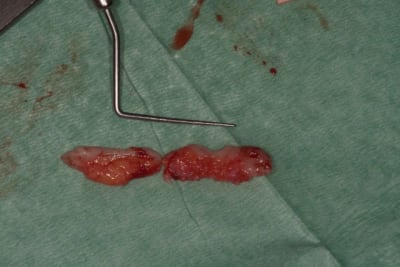20110108  mg 0024 qguglm - Eugenol