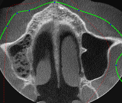 2012 02 21 081855 f5jedf - Eugenol